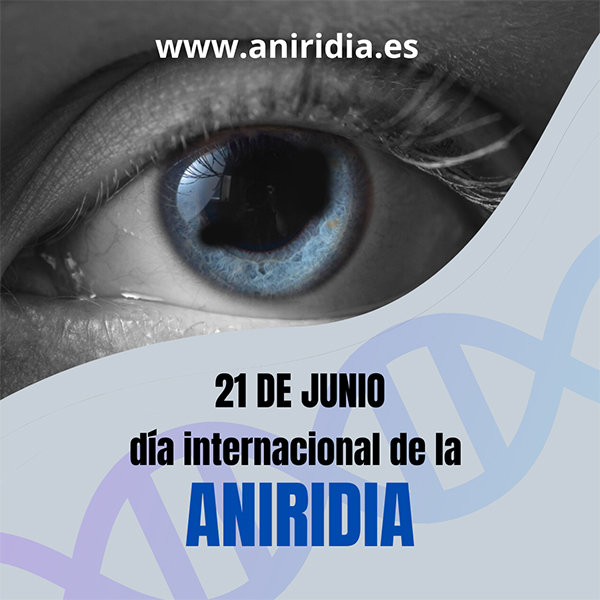 Se estima que una de cada 80 mil personas tiene Aniridia